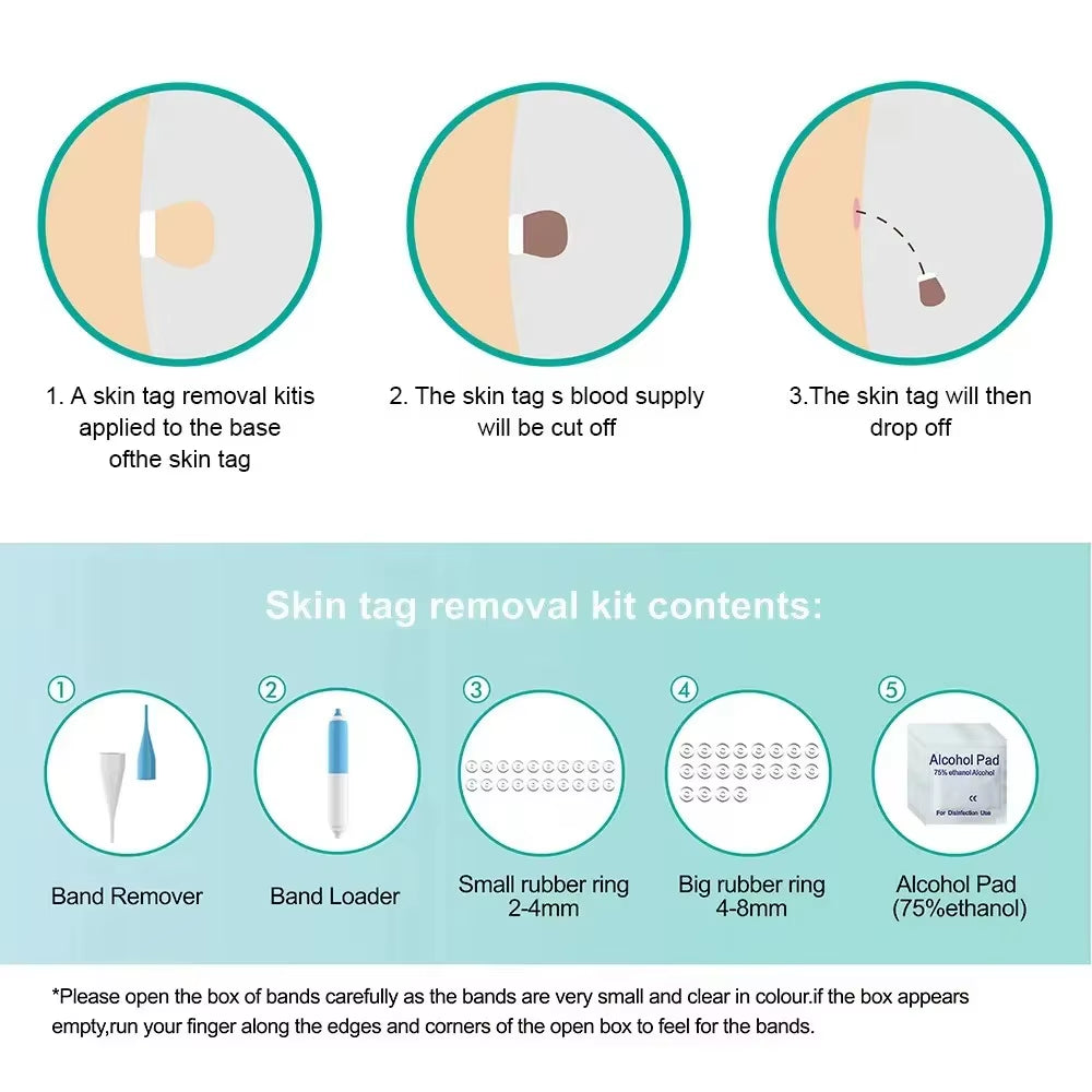 Skin Tag Removal Tool Rubber Rings Face Beauty Accessories Skin Tag Removal Device Multipurpose Supplies for Face Neck Chin Back