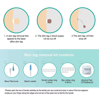 Skin Tag Removal Tool Rubber Rings Face Beauty Accessories Skin Tag Removal Device Multipurpose Supplies for Face Neck Chin Back